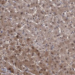 Invitrogen GPT Polyclonal Antibody 100 &mu;L; Unconjugated:Antibodies,