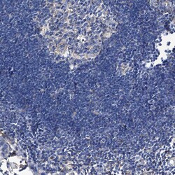 Invitrogen GPT Polyclonal Antibody 100 &mu;L; Unconjugated:Antibodies,