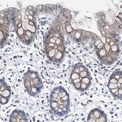 Invitrogen GPT Polyclonal Antibody 100 &mu;L; Unconjugated:Antibodies,