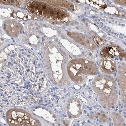 Invitrogen GPT Polyclonal Antibody 100 &mu;L; Unconjugated:Antibodies,