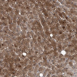 Invitrogen GPT Polyclonal Antibody 100 &mu;L; Unconjugated:Antibodies,