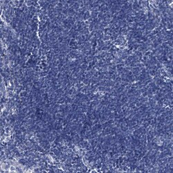 Invitrogen GPT Polyclonal Antibody 100 &mu;L; Unconjugated:Antibodies,