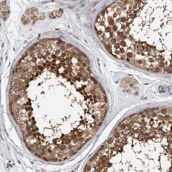 Invitrogen TCP1 Polyclonal Antibody 100 &mu;L; Unconjugated:Antibodies,