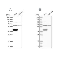 Invitrogen TCP1 Polyclonal Antibody 100 &mu;L; Unconjugated:Anticuerpos