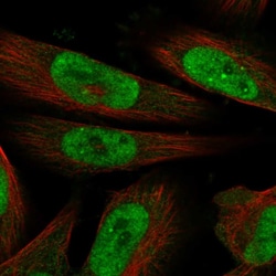 Invitrogen MLLT1 Polyclonal Antibody 100 &mu;L; Unconjugated:Antibodies,