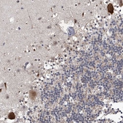 Invitrogen MLLT1 Polyclonal Antibody 100 &mu;L; Unconjugated:Antibodies,