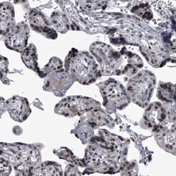 Invitrogen MLLT1 Polyclonal Antibody 100 &mu;L; Unconjugated:Antibodies,