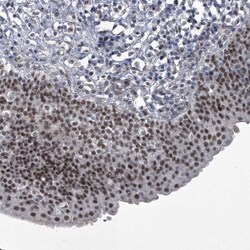 Invitrogen MLLT1 Polyclonal Antibody 100 &mu;L; Unconjugated:Antibodies,