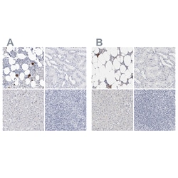 Invitrogen CD41 Polyclonal Antibody 100 &mu;L | Buy Online | Invitrogen&trade; | Fisher Scientific