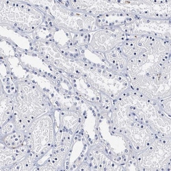 Invitrogen CD41 Polyclonal Antibody 100 &mu;L; Unconjugated:Antibodies,
