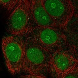 TSSC1 Polyclonal Antibody, Invitrogen™