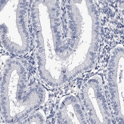 Invitrogen CRISP2 Polyclonal Antibody 100 &mu;L; Unconjugated:Antibodies,