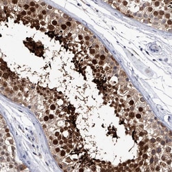 Invitrogen CRISP2 Polyclonal Antibody 100 &mu;L; Unconjugated:Antibodies,