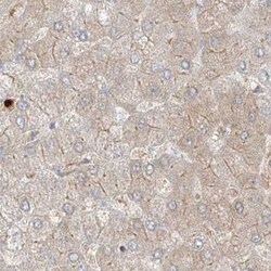 Invitrogen PGD Polyclonal Antibody 100 &mu;L | Buy Online | Invitrogen&trade; | Fisher Scientific