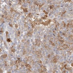 Invitrogen PGD Polyclonal Antibody 100 &mu;L | Buy Online | Invitrogen&trade; | Fisher Scientific