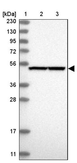 Invitrogen PGD Polyclonal Antibody 100 &mu;L | Buy Online | Invitrogen&trade; | Fisher Scientific
