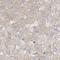Invitrogen PGD Polyclonal Antibody 100 &mu;L; Unconjugated:Antikörper