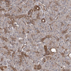 Invitrogen APAF1 Polyclonal Antibody 100 &mu;L; Unconjugated:Antibodies,