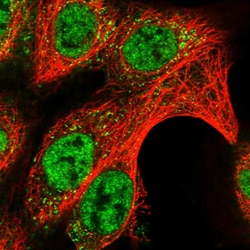 Invitrogen DUSP22 Polyclonal Antibody 100 &mu;L; Unconjugated:Antibodies,