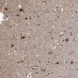 Invitrogen DUSP22 Polyclonal Antibody 100 &mu;L; Unconjugated:Antibodies,