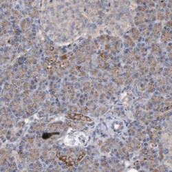 Invitrogen DUSP22 Polyclonal Antibody 100 &mu;L; Unconjugated:Antibodies,