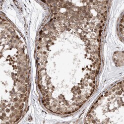 Invitrogen DUSP22 Polyclonal Antibody 100 &mu;L; Unconjugated:Antibodies,