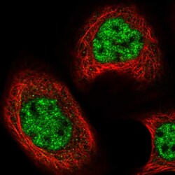 Invitrogen CBX8 Polyclonal Antibody 100 &mu;L; Unconjugated:Antibodies,