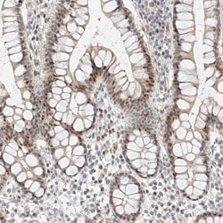 Invitrogen CBX8 Polyclonal Antibody 100 &mu;L; Unconjugated:Antibodies,