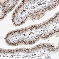 Invitrogen CBX8 Polyclonal Antibody 100 &mu;L; Unconjugated:Antibodies,