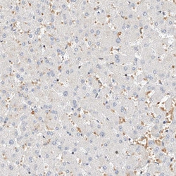 Invitrogen CBX8 Polyclonal Antibody 100 &mu;L; Unconjugated:Antibodies,