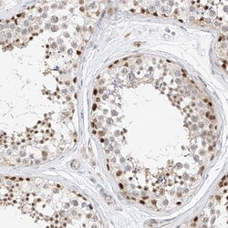 Invitrogen CBX8 Polyclonal Antibody 100 &mu;L; Unconjugated:Antibodies,