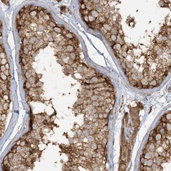 Invitrogen CAPZB Polyclonal Antibody 100 &mu;L; Unconjugated:Antibodies,
