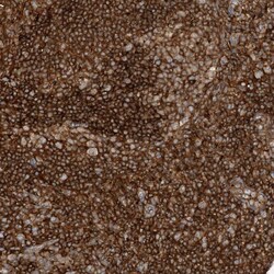 Invitrogen CAPZB Polyclonal Antibody 100 &mu;L; Unconjugated:Antibodies,
