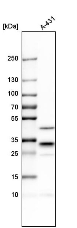 Invitrogen CAPZB Polyclonal Antibody 100 &mu;L | Buy Online | Invitrogen&trade; | Fisher Scientific
