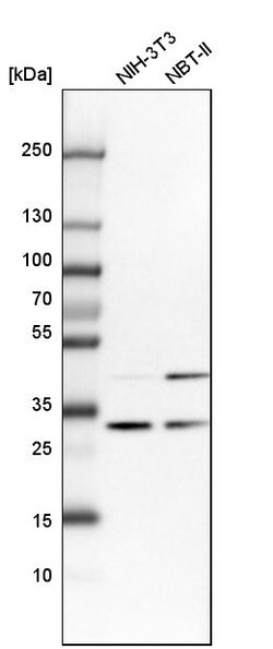 Invitrogen CAPZB Polyclonal Antibody 100 &mu;L | Buy Online | Invitrogen&trade; | Fisher Scientific