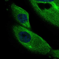 Invitrogen DCDC2 Polyclonal Antibody 100 &mu;L; Unconjugated:Antibodies,