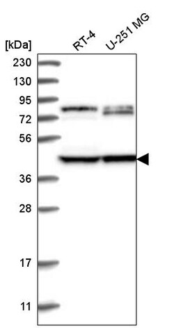 Invitrogen DCDC2 Polyclonal Antibody 100 &mu;L; Unconjugated:Antibodies,
