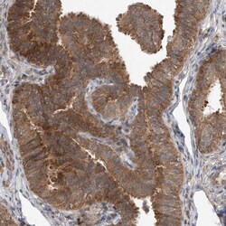 Invitrogen LATS1 Polyclonal Antibody 100 &mu;L; Unconjugated:Antibodies,