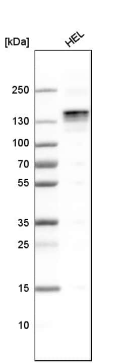Invitrogen LATS1 Polyclonal Antibody 100 &mu;L; Unconjugated:Antibodies,