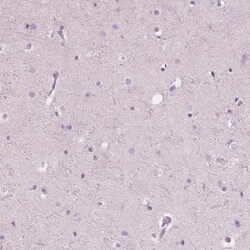 Invitrogen CXCR2 Polyclonal Antibody 100 &mu;L; Unconjugated:Antibodies,