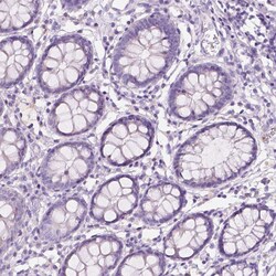 Invitrogen CXCR2 Polyclonal Antibody 100 &mu;L; Unconjugated:Antibodies,