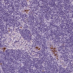 Invitrogen CXCR2 Polyclonal Antibody 100 &mu;L; Unconjugated:Antibodies,