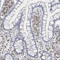 Invitrogen ZC3H12A Polyclonal Antibody 100 &mu;L | Buy Online | Invitrogen&trade; | Fisher Scientific
