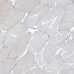 Invitrogen ZC3H12A Polyclonal Antibody 100 &mu;L | Buy Online | Invitrogen&trade; | Fisher Scientific