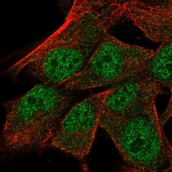 Invitrogen TRSPAP1 Polyclonal Antibody 100 &mu;L; Unconjugated:Antibodies,