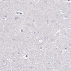 Invitrogen CD37 Polyclonal Antibody 100 &mu;L | Buy Online | Invitrogen&trade; | Fisher Scientific