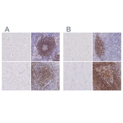 Invitrogen CD37 Polyclonal Antibody 100 &mu;L | Buy Online | Invitrogen&trade; | Fisher Scientific
