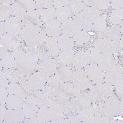 Invitrogen CD37 Polyclonal Antibody 100 &mu;L | Buy Online | Invitrogen&trade; | Fisher Scientific
