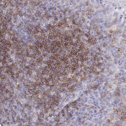Invitrogen CD37 Polyclonal Antibody 100 &mu;L | Buy Online | Invitrogen&trade; | Fisher Scientific