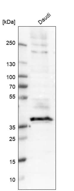 Invitrogen CD37 Polyclonal Antibody 100 &mu;L | Buy Online | Invitrogen&trade; | Fisher Scientific